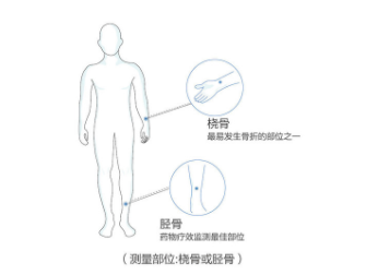 超声草莓视频黄色成人仪价格桡骨测草莓视频黄色成人的准确率高吗