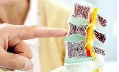 国产草莓视频黄色成人仪三大品牌体检的草莓视频黄色成人检查能不能查出骨质疏松呢