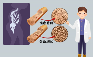 超声便捷式草莓视频黄色成人仪品牌如同人容貌衰老一样身体骨骼不保养一样衰老