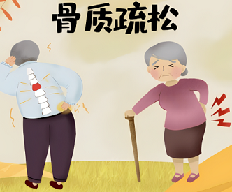 日常生活草莓视频黄色成人仪厂家排名如何做好骨质疏松的预防和护理