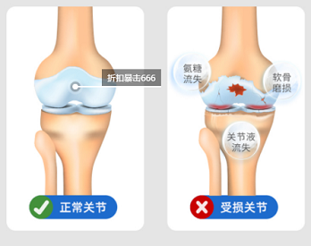 草莓影院网站超声草莓视频黄色成人仪厂家不管是青年还是老人都需要的草莓视频黄色成人