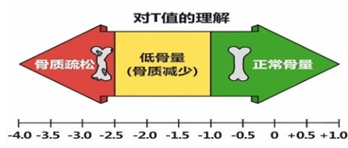 国产草莓视频黄色成人仪三大品牌判断骨质变化当T值<-2.5存在低骨量情况
