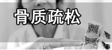 草莓视频黄色成人检测仪品牌X射线比超声波检测的哪个贵 两种原理的区别