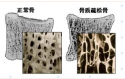 随着年龄的增长，你变矮了吗?超声波草莓视频黄色成人仪的厂家已经揭示了他们的秘密