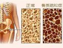 超声草莓视频黄色成人检测仪厂家在体检时检测到的桡骨和胫骨部位的草莓视频黄色成人是准确的