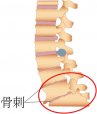 吉林长春|草莓影院网站超声草莓视频黄色成人仪厂家品牌分享：为什么现在的年轻人也存在骨刺增生?