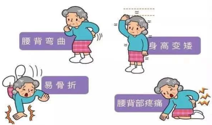 （辽宁沈阳）超声草莓视频黄色成人检测分析仪警惕骨质疏松 草莓视频黄色成人筛查也很重要！