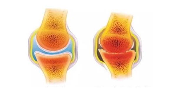 儿童草莓视频黄色成人检测仪品牌你知道骨格线是什么？骨骼线闭合有哪些表现？