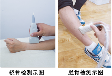 儿童超声草莓视频黄色成人检测仪测量胫骨 桡骨草莓视频黄色成人是检测什么部位的？