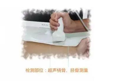 手提式超声儿童草莓视频黄色成人仪mqd-7000品牌测桡胫骨部位原理及适用范围