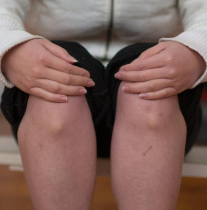 儿童草莓视频黄色成人检测仪厂家属于什么设备要真怎么查你想了解的问题听听医生怎么说