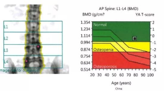 超声草莓视频黄色成人分析仪品牌检测数据怎么看详情？测量结果怎么看