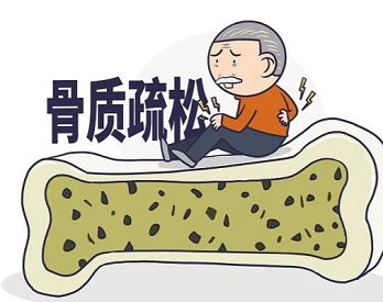 体检的便携式草莓视频黄色成人检测仪检查能不能精准查出骨质疏松呢？